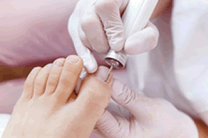 Pedicure
